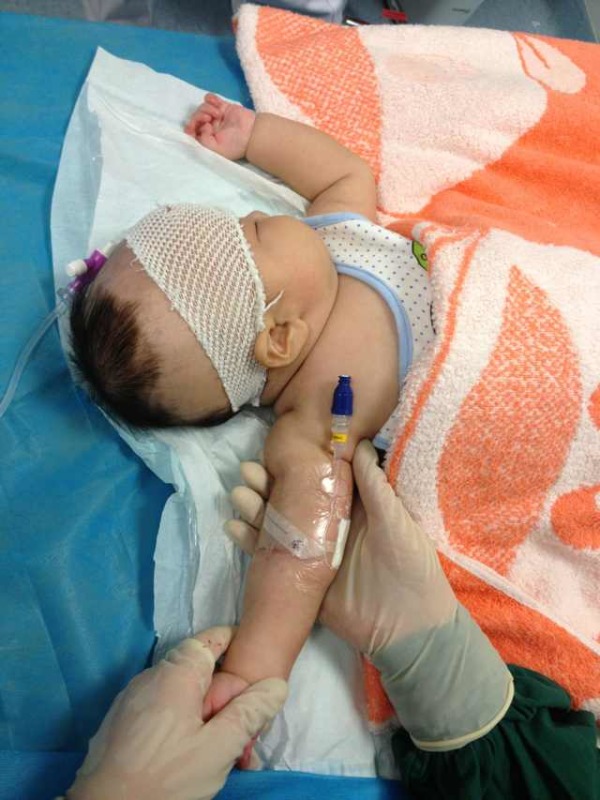 2个月婴幼儿PICC置管.jpg